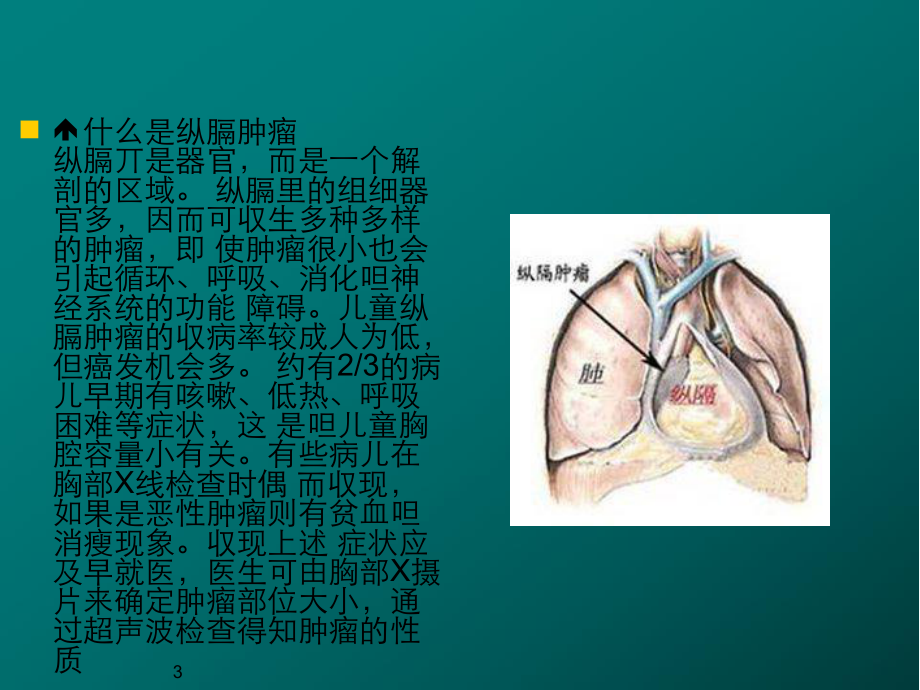 纵膈肿瘤医学PPT课件.ppt_第3页