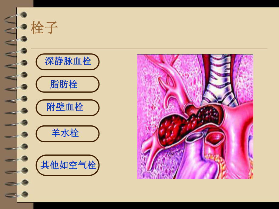 肺栓塞课件PPT.ppt_第3页