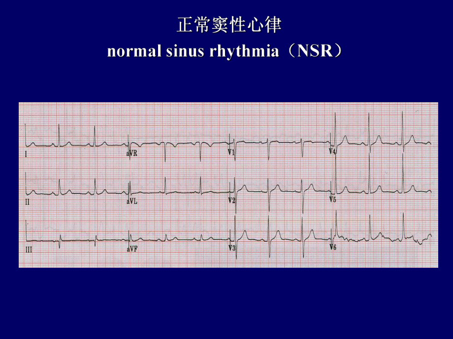 心电图练习题.ppt_第2页