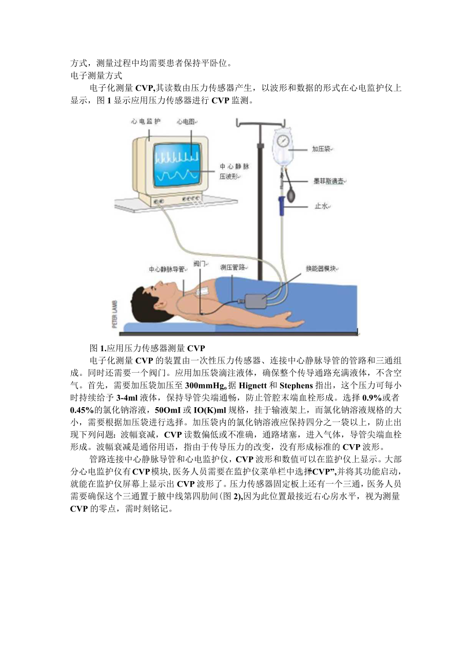 CVP监测在危重病中的应用与CVP监测在重症肺炎中的临床应用.docx_第3页