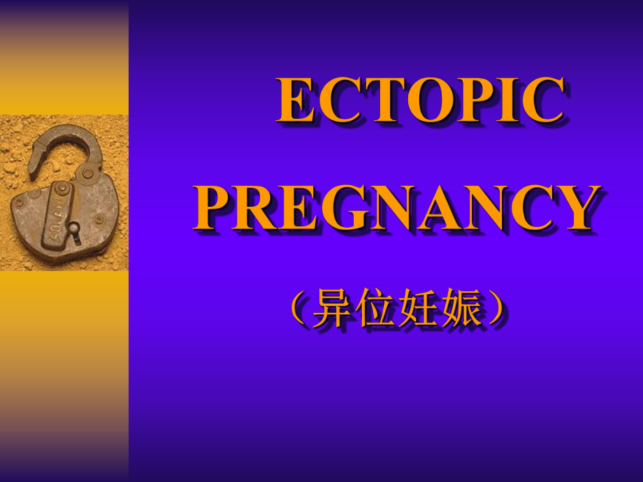 ECTOPIC(课件).ppt_第1页