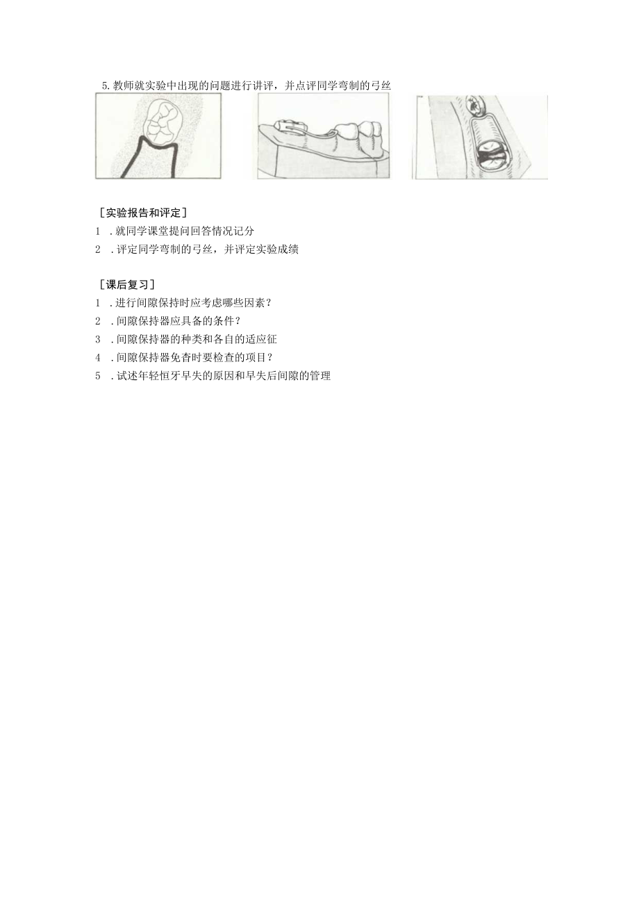 华北理工儿童口腔医学实验指导03间隙管理和间隙保持器.docx_第2页