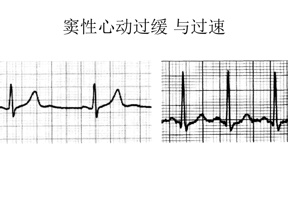 心电图练习题.ppt_第2页