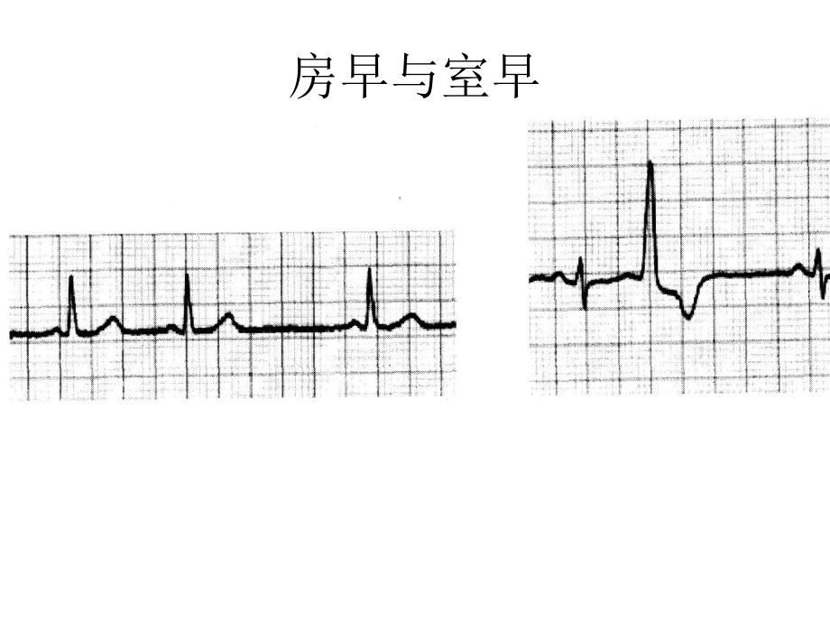 心电图练习题.ppt_第3页