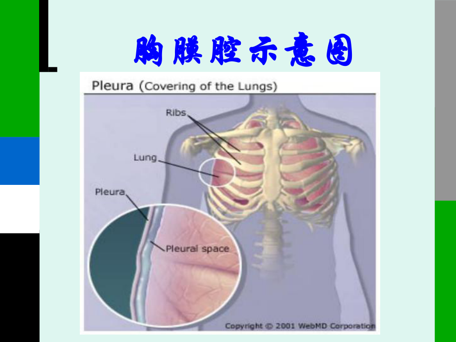 胸膜疾病课件.ppt_第2页