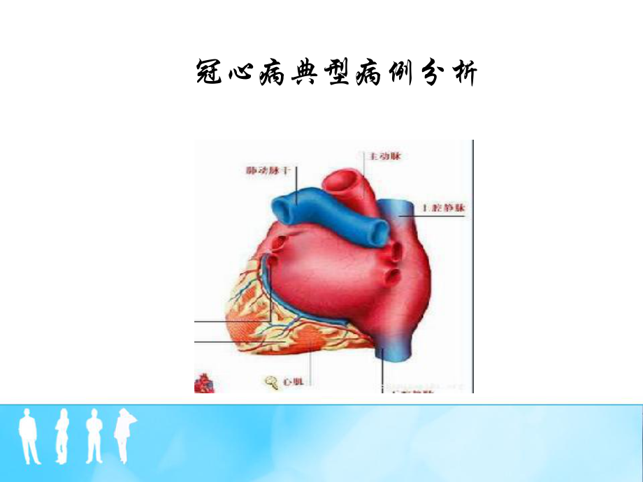 冠心病典型病例.pptx_第1页