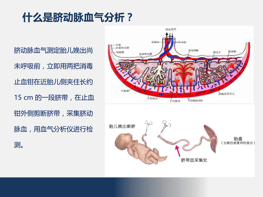 脐动脉血血气分析的临床应用.pptx_第2页