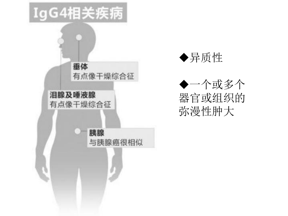 IgG4相关性疾病精品医学课件.pptx_第3页