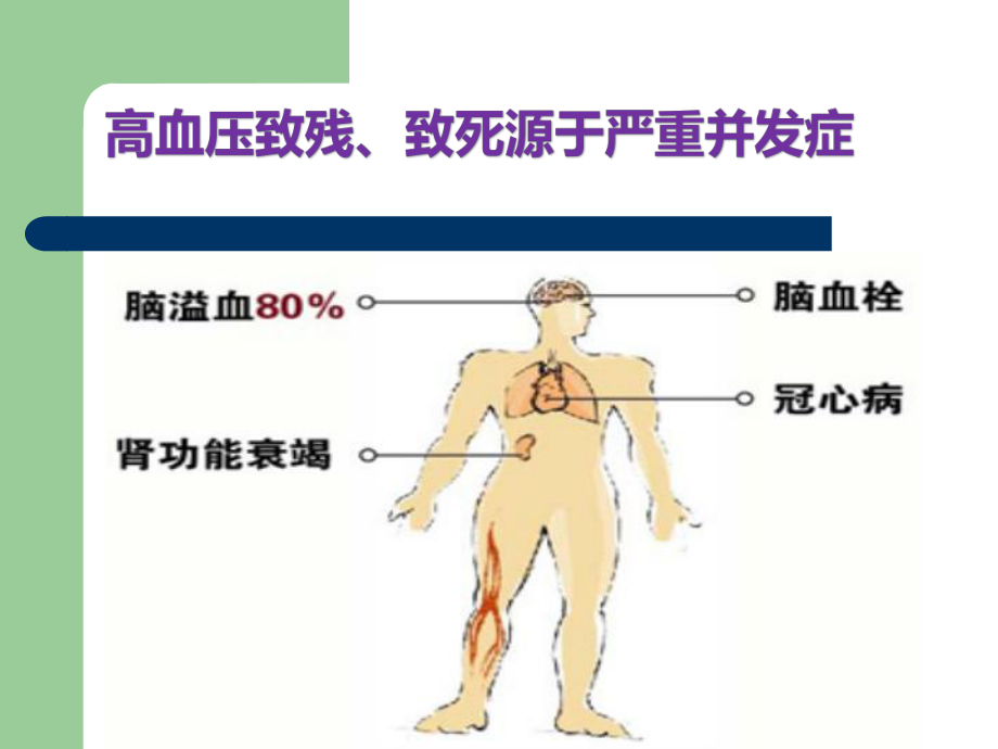 高血压饮食与运动.pptx_第3页