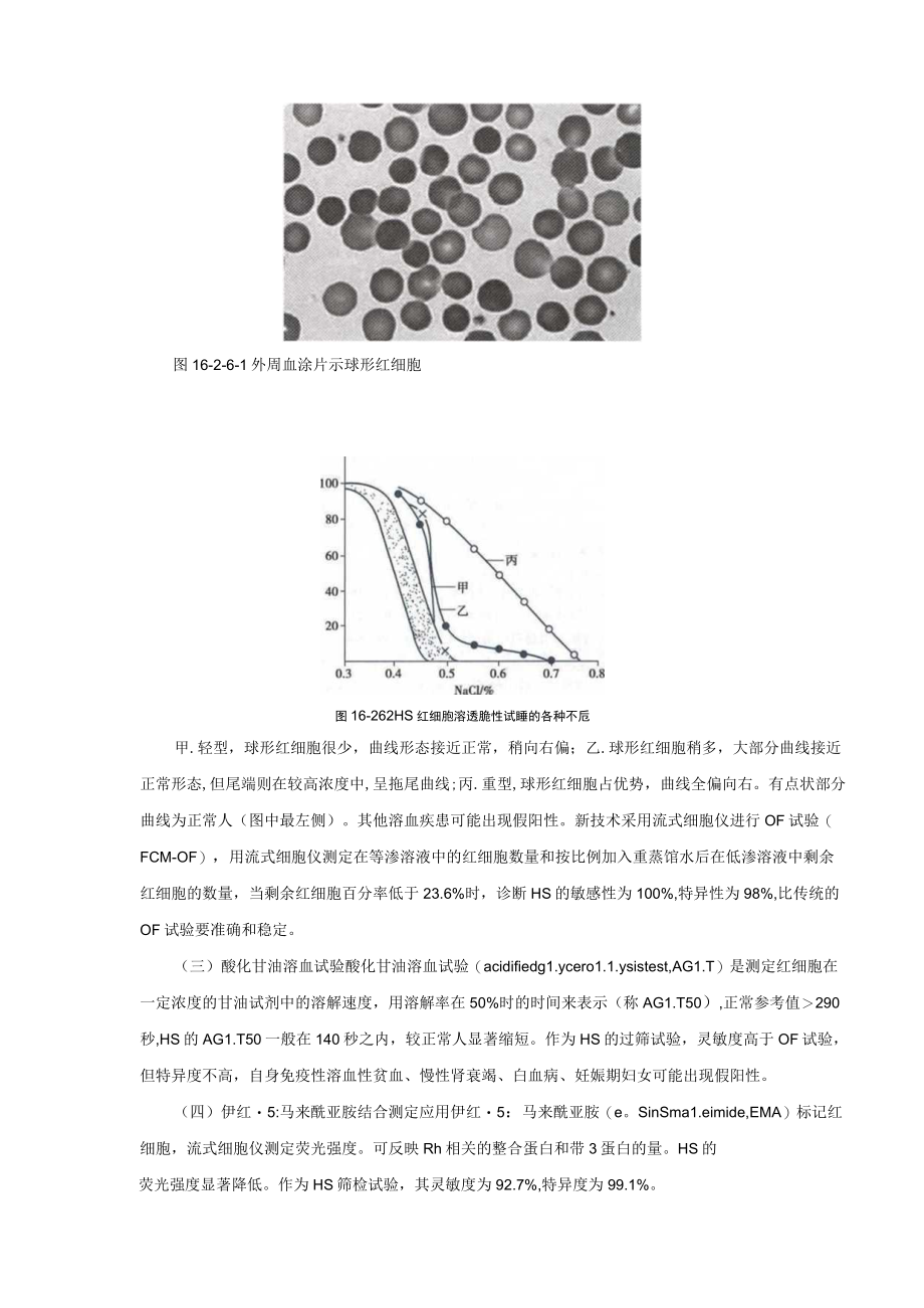 红细胞膜缺陷所致的溶血性贫血诊疗规范2022版.docx_第3页