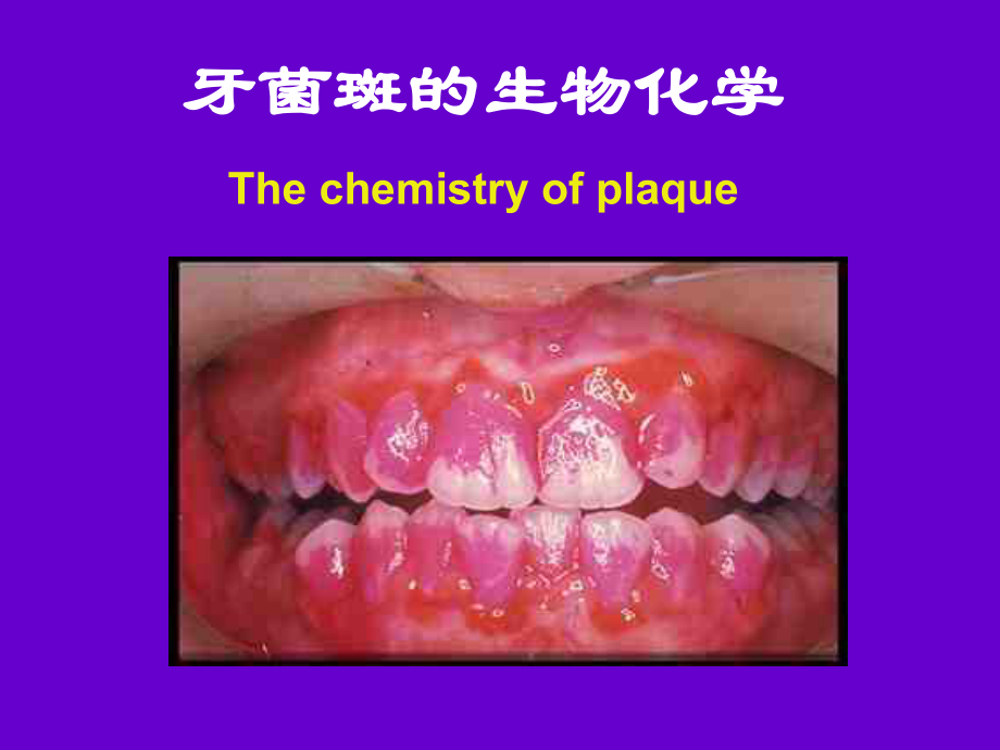 牙菌斑的生物化学.pptx_第1页