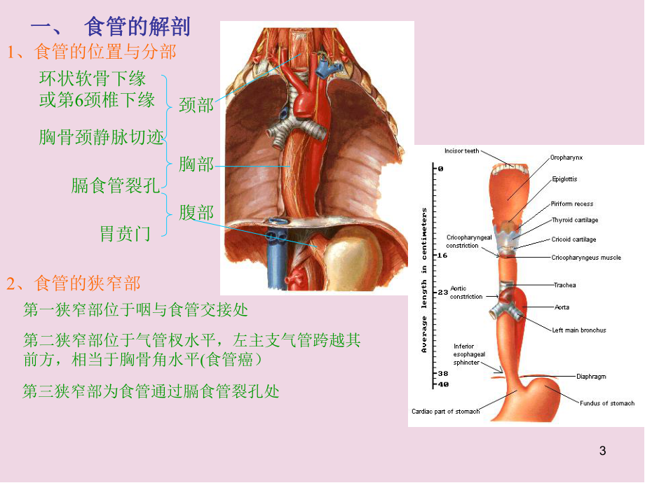 食管癌术式医学PPT课件.ppt_第3页