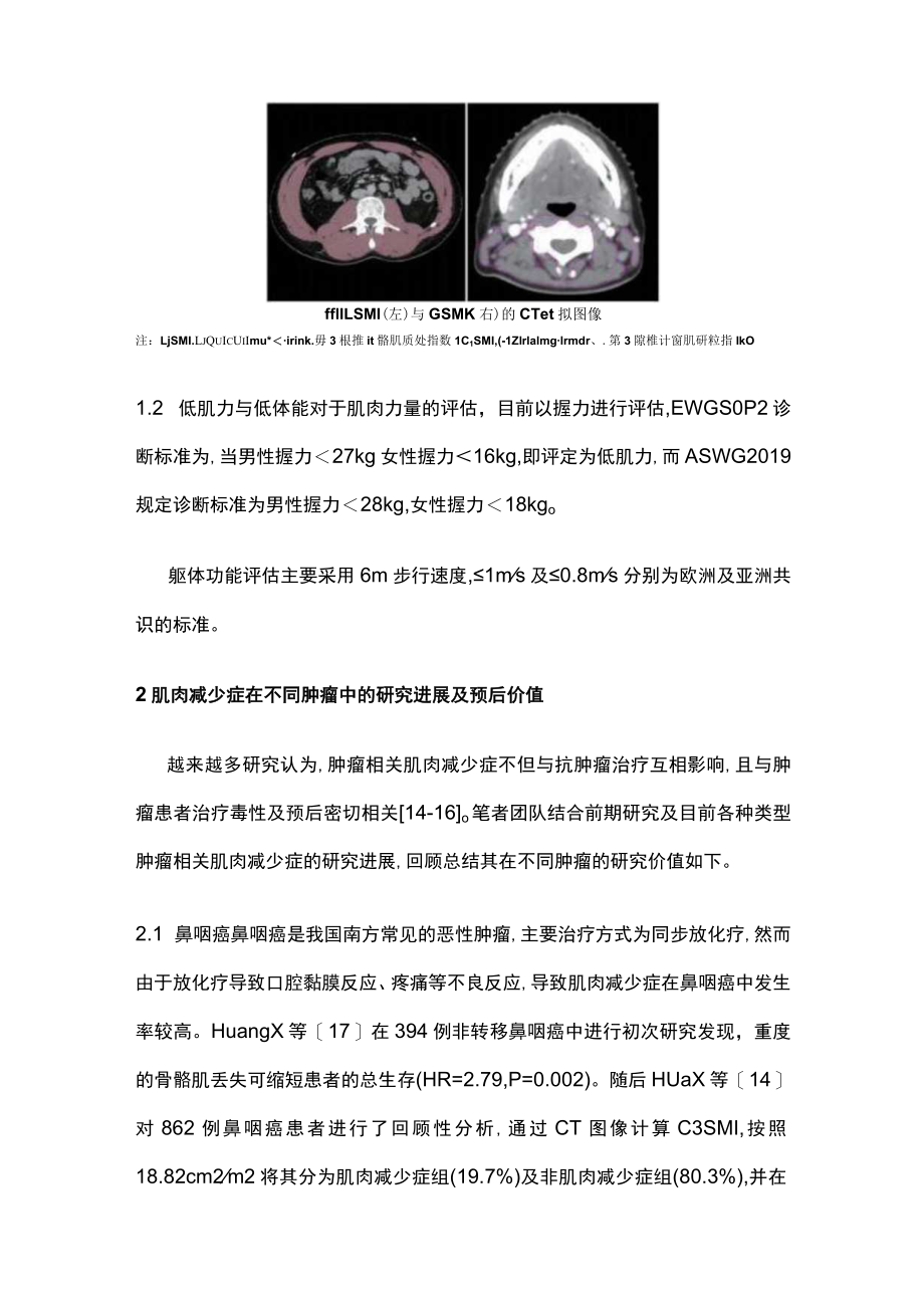 2023肌肉减少症与肿瘤预后的研究进展.docx_第3页