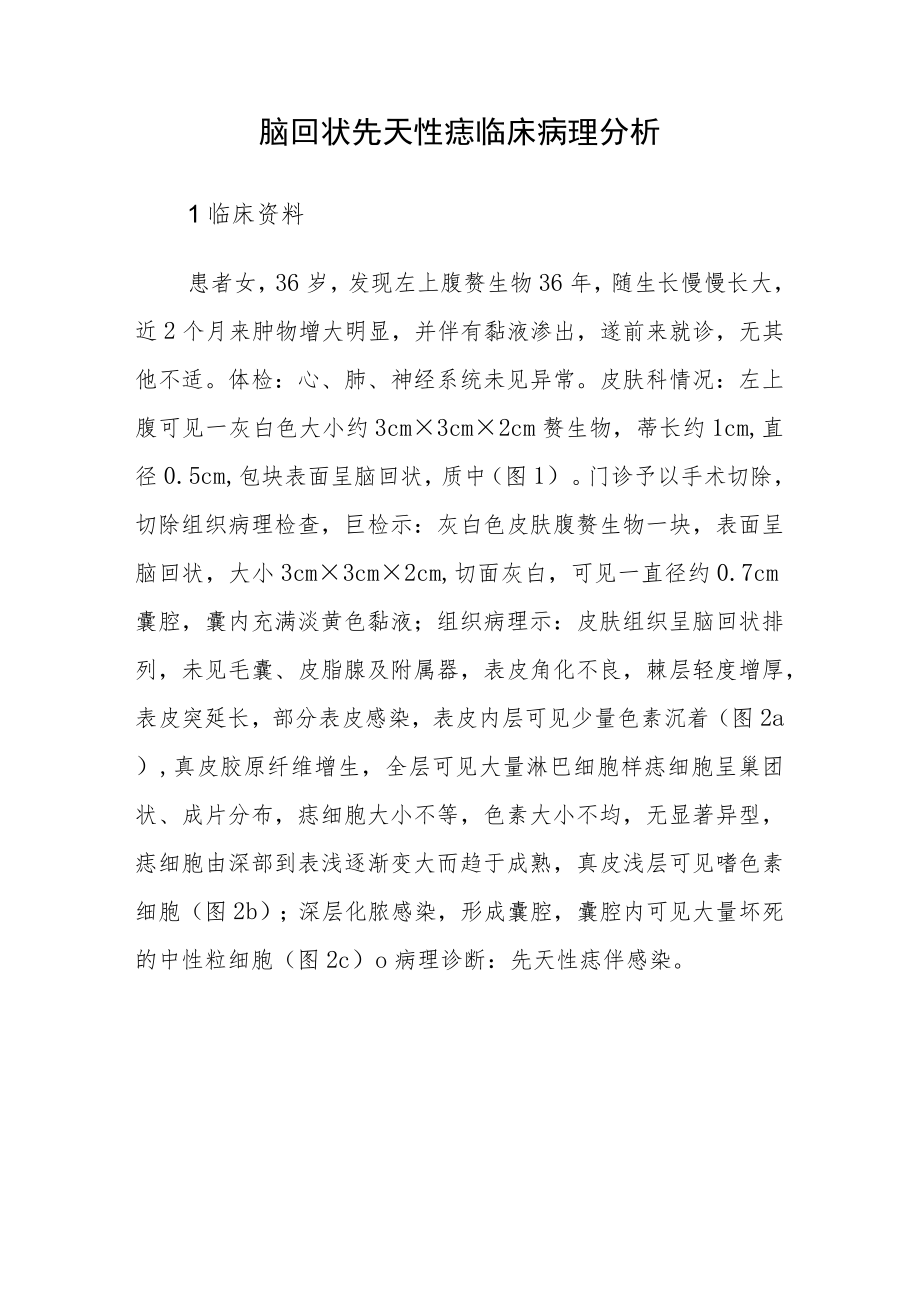 病理科医师晋升副主任（主任）医师高级职称病例分析专题报告（脑回状先天性痣）.docx_第2页