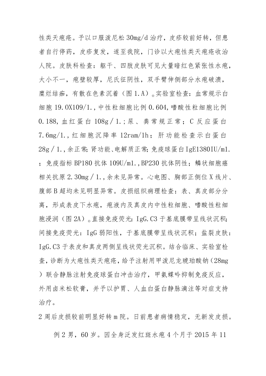 皮肤科外伤诱发自身免疫性大疱性皮肤病病例分析专题报告.docx_第2页