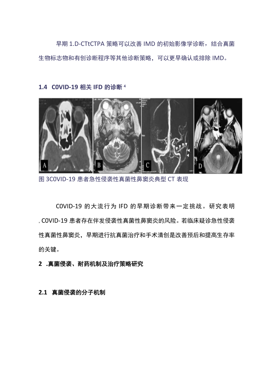 2022侵袭性真菌病诊断治疗进展（全文）.docx_第3页