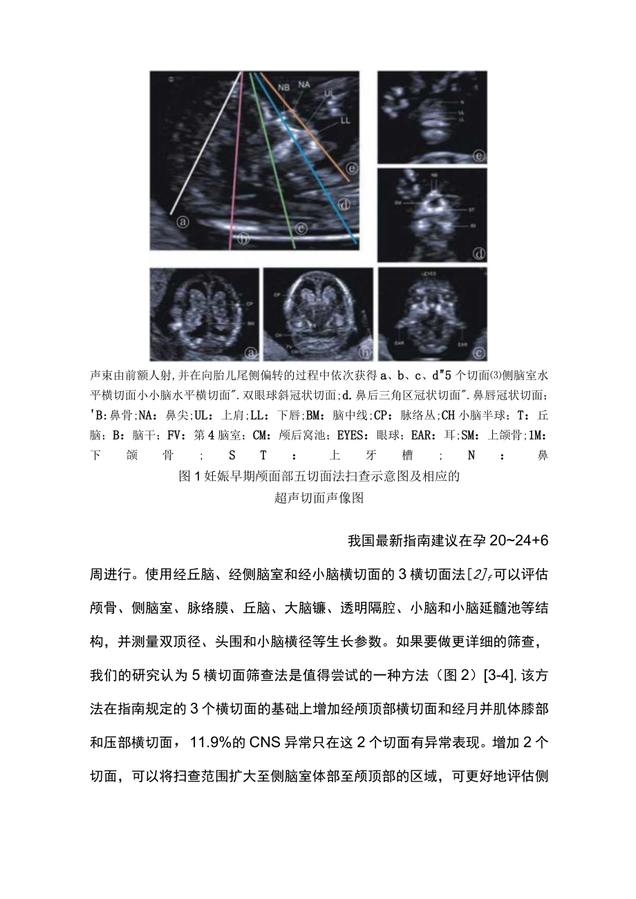 胎儿常见中枢神经系统异常的临床咨询（全文）.docx_第3页