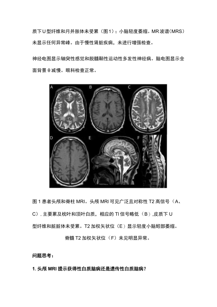 轻患者出现亚急性痉挛性截瘫（全文）.docx_第2页