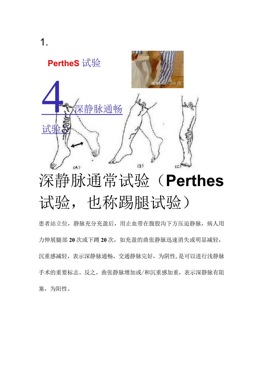 深静脉通常试验（Perthes试验也称踢腿试验）.docx_第1页