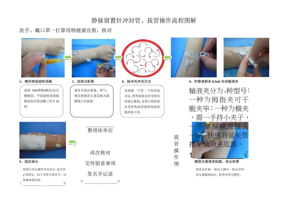 静脉留置针穿刺、冲封管及拔管图解流程.docx_第2页