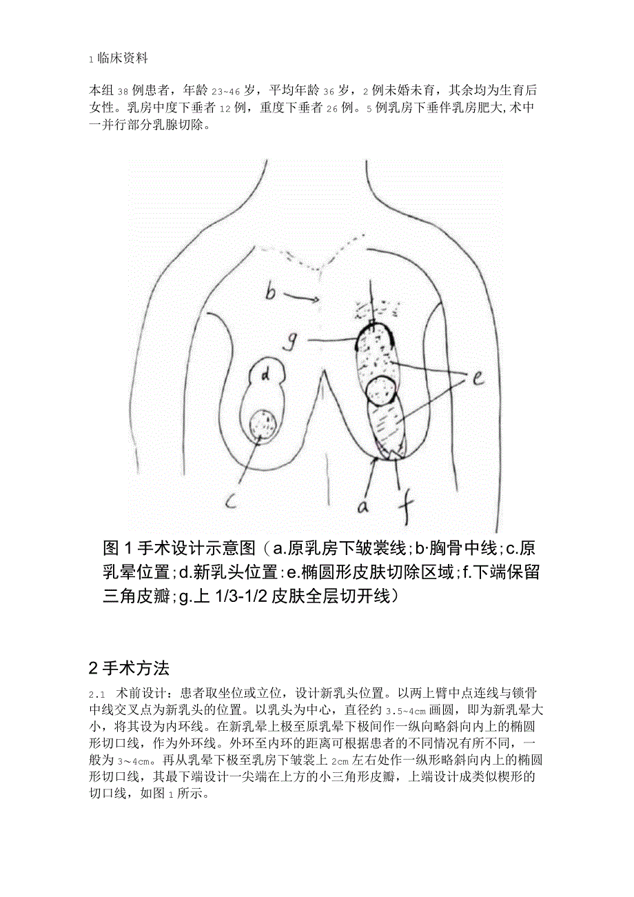 医美整形乳房下垂矫治术培训课件.docx_第2页