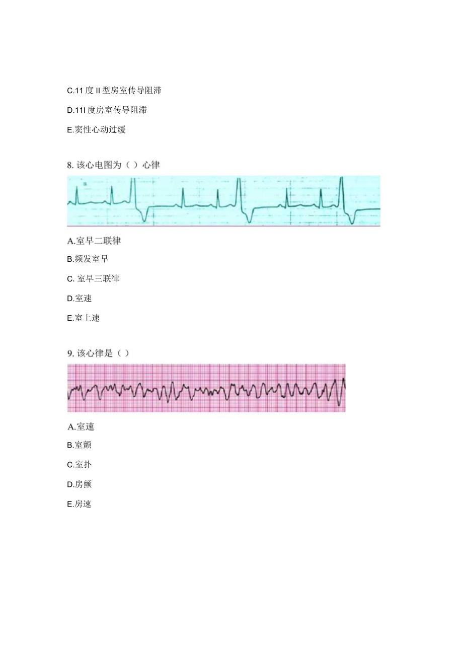 2023年常见异常心电图正确率识别试题.docx_第3页