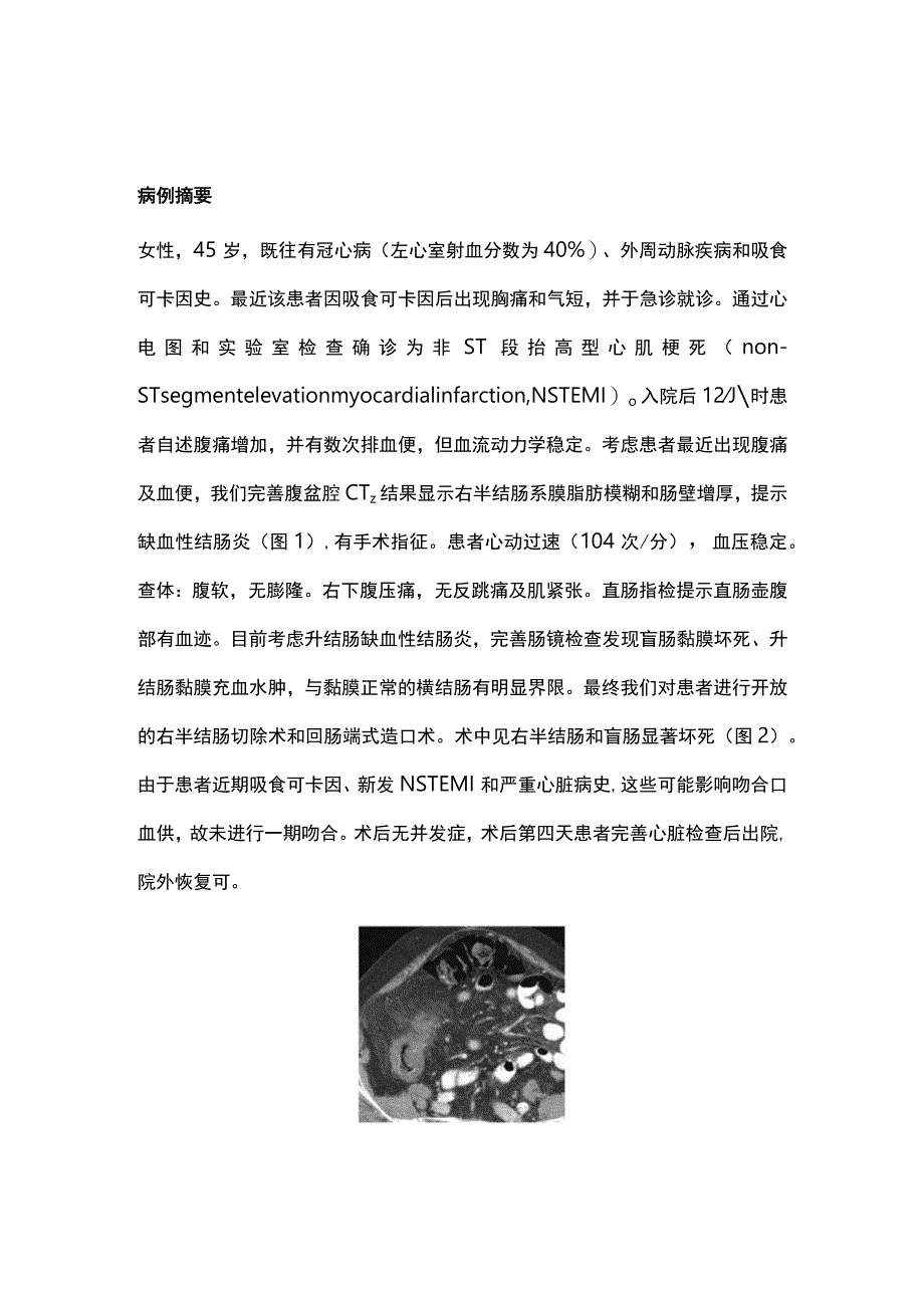 2023缺血性结肠炎的诊断和治疗.docx_第1页