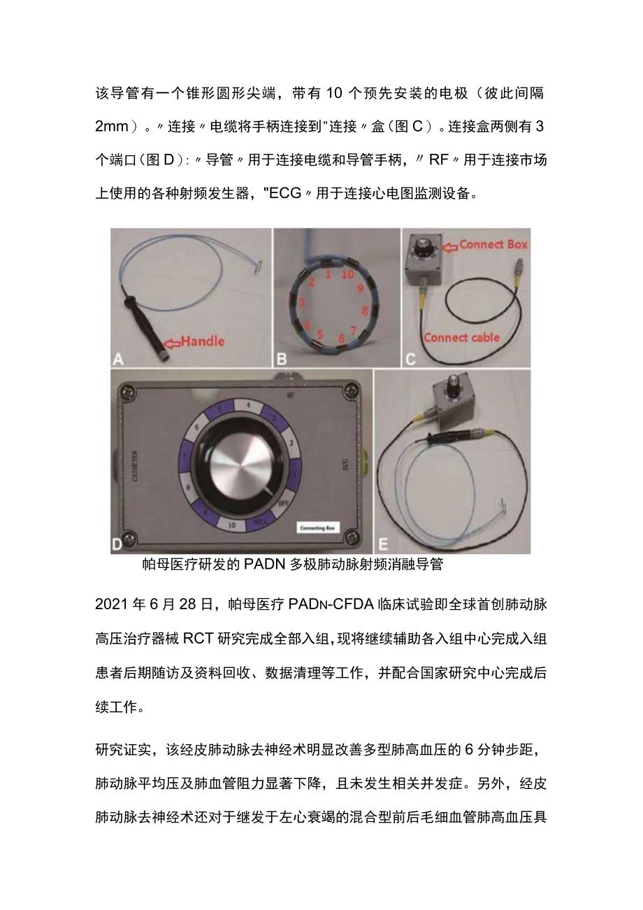 2023经皮肺动脉去神经术器械：射频 vs. 超声导管消融.docx_第2页