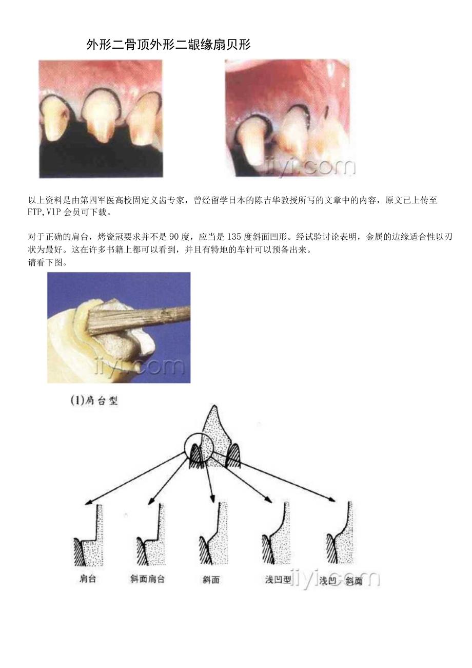 固定义齿基牙预备.docx_第2页