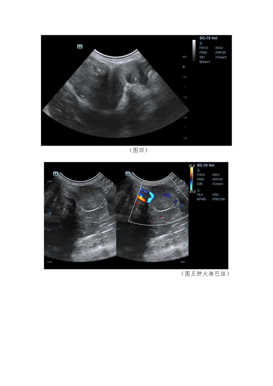 胃肠超声造影在胃肠占位中的应用.docx_第3页