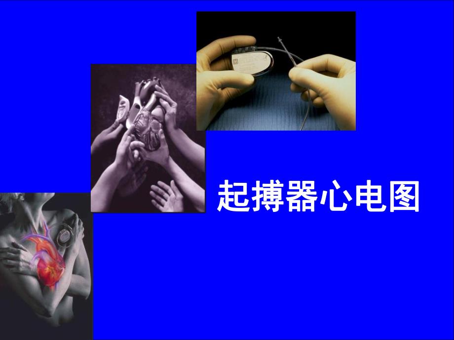 起搏器心电图.ppt_第1页