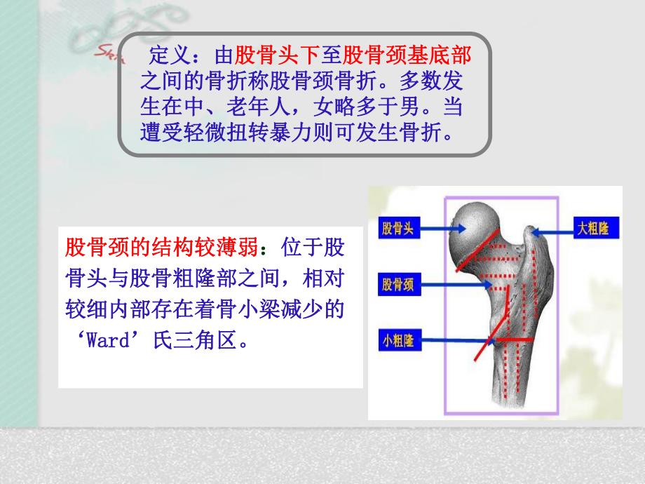 髋关节置换术后护理.ppt_第2页