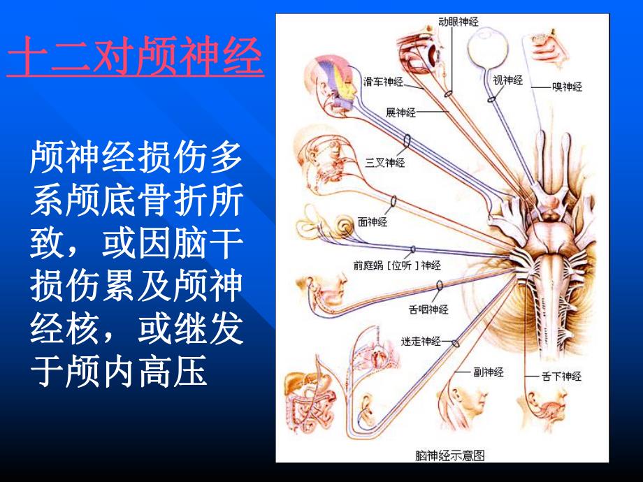 颅脑损伤合并颅神经损伤的临床表现.ppt_第2页