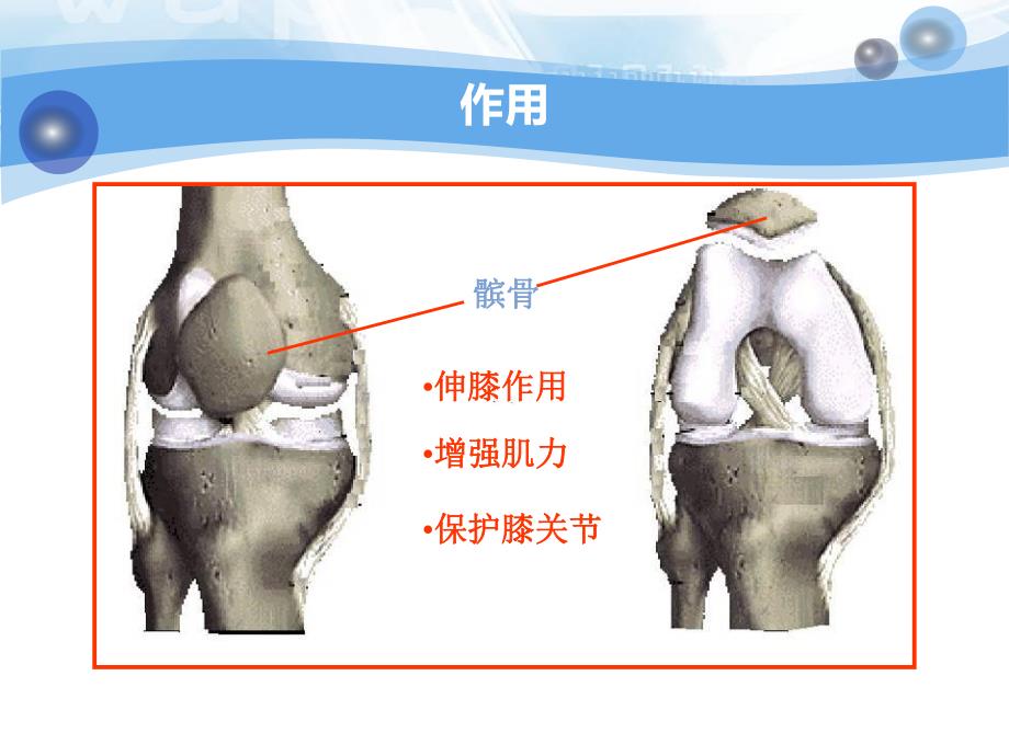 髌骨骨折护理查房.ppt_第3页