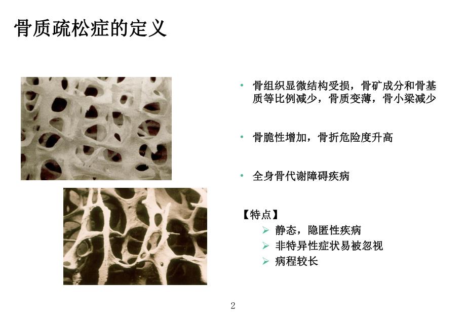 骨标志物检测的临床应用.ppt_第2页