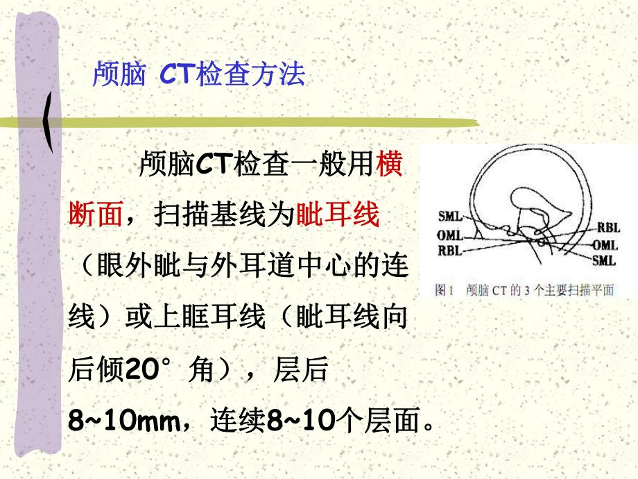 颅脑断面解剖.ppt_第3页