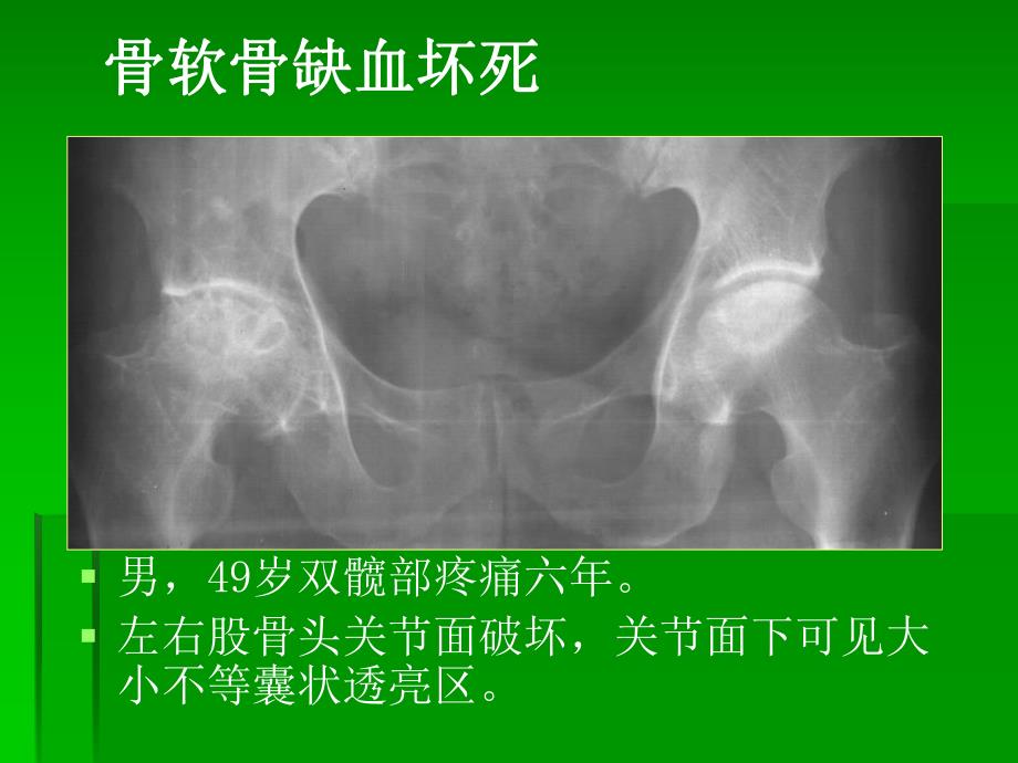 骨与关节3new.ppt_第3页