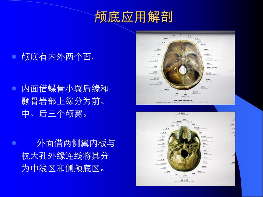 颅底应用解剖.ppt_第3页