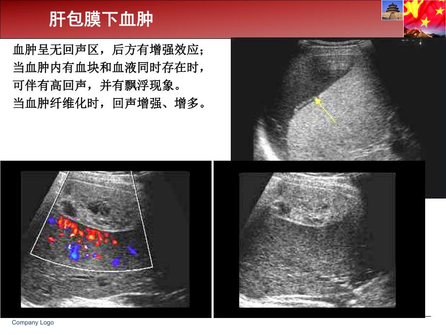 超声在急诊中的应用.ppt_第3页