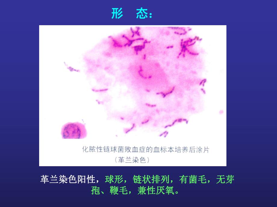 链球菌感染幻灯.ppt_第2页