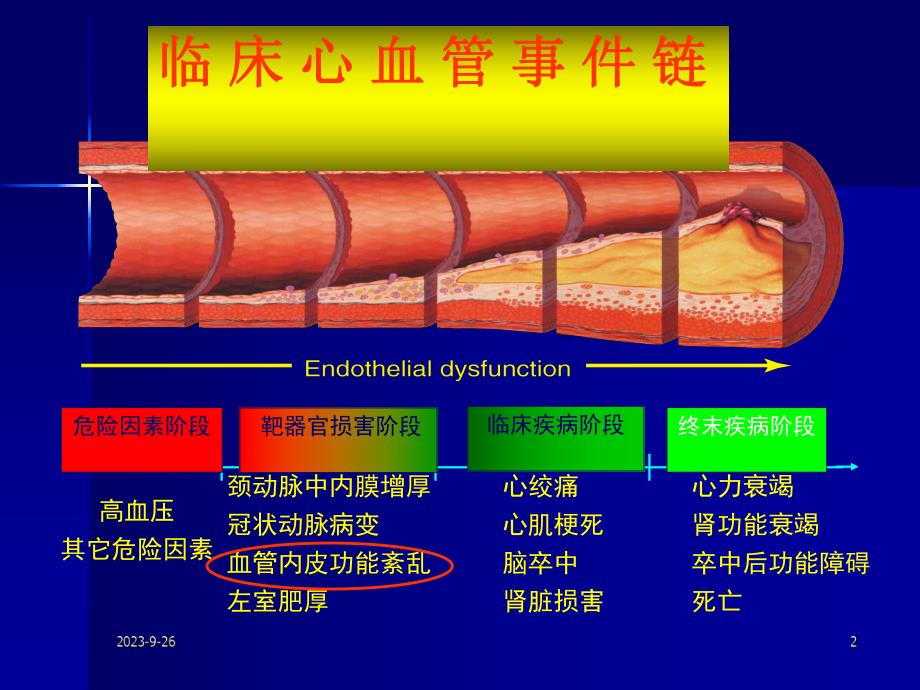 顽固性高血压.ppt_第2页