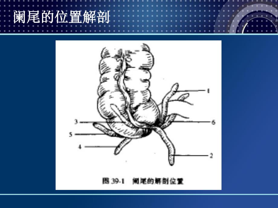 阑尾炎诊断治疗手术课件.ppt_第3页