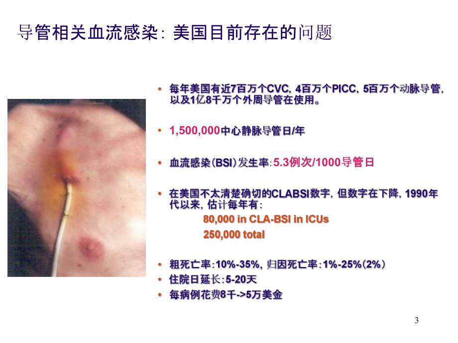 预防导管相关性血流感染CDC指南解读.ppt_第3页