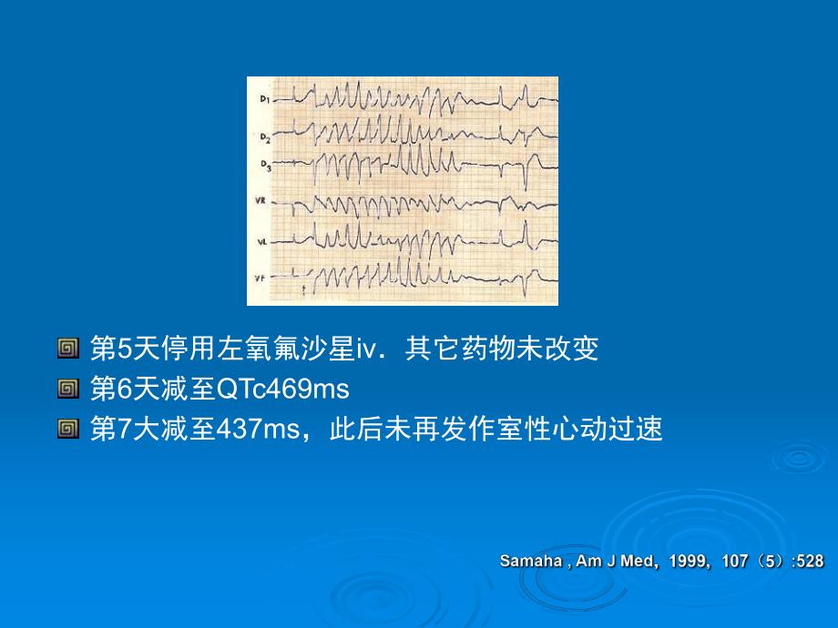 非抗心律失常药物致心律失常作用.ppt_第3页