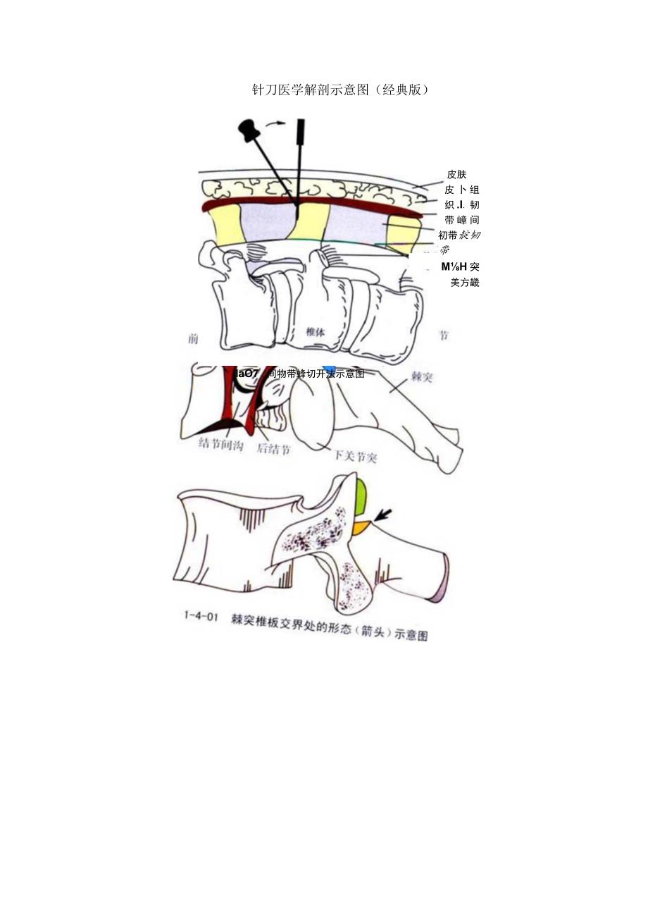 针刀医学《针刀入路示意图》.docx_第1页