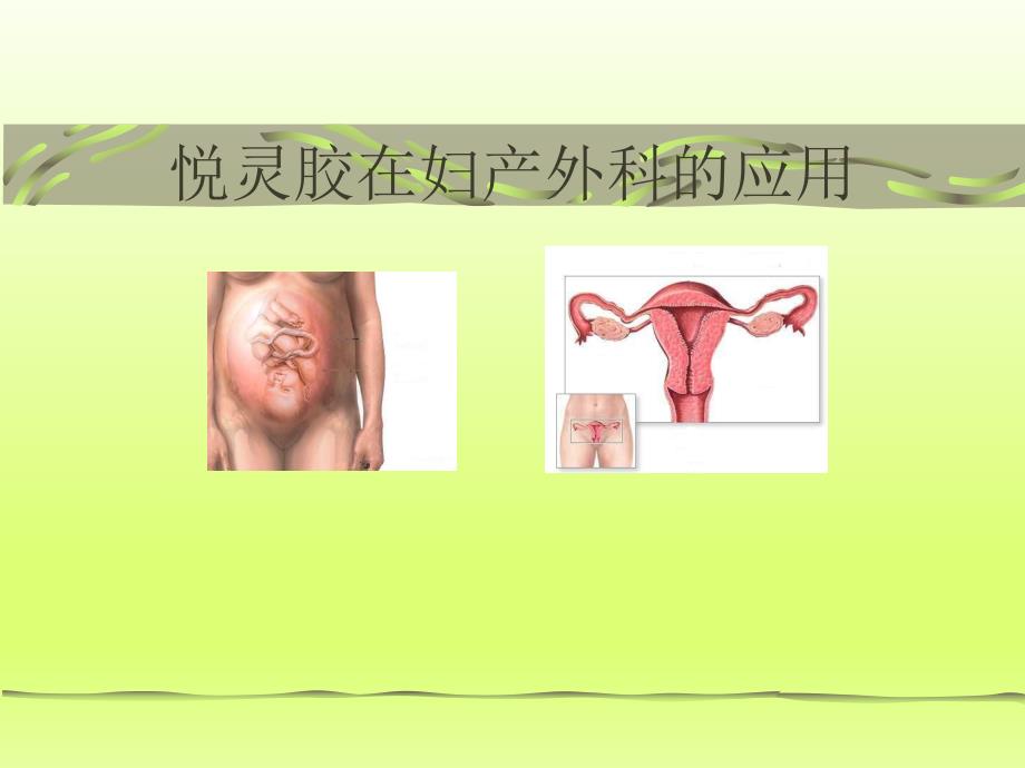 “悦灵胶”妇产科应用.ppt_第1页