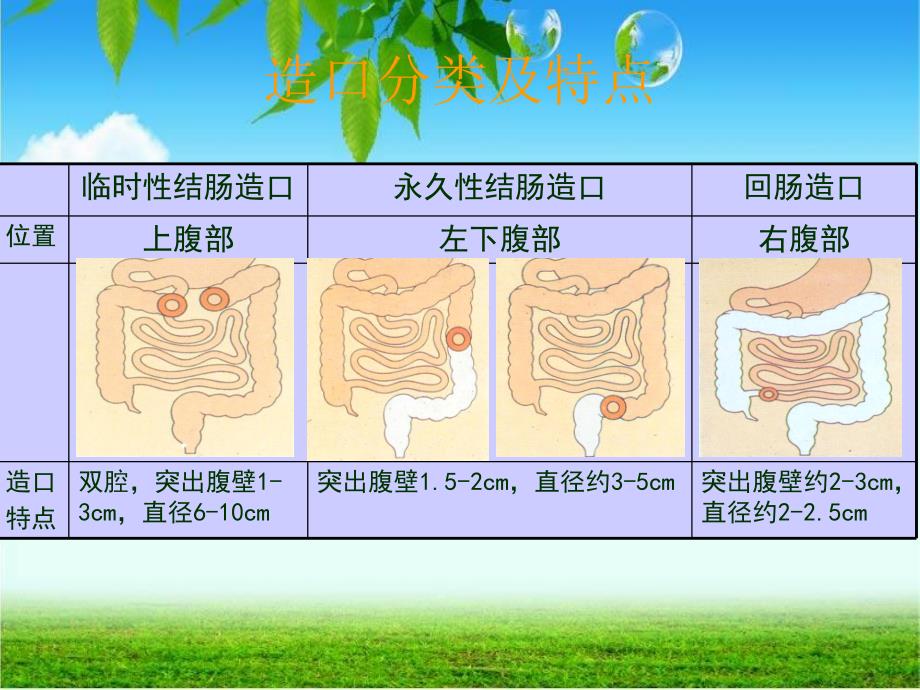 肠造口护理9wppt课件.ppt_第2页