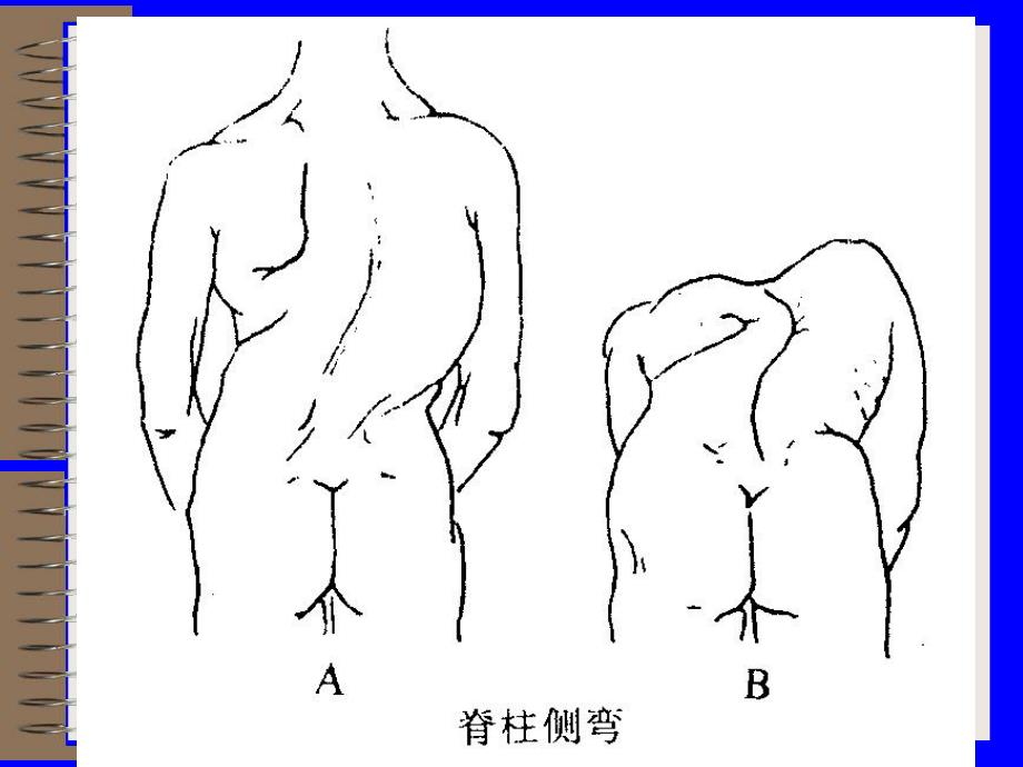 脊柱和四肢的检查.ppt_第3页