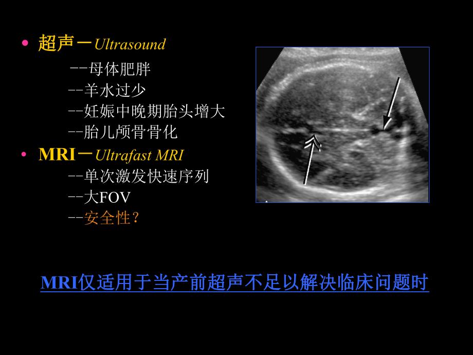 胎儿磁共振成像MRImagingoftheFetu.ppt_第2页