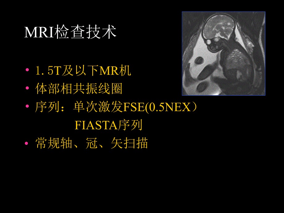 胎儿磁共振成像MRImagingoftheFetu.ppt_第3页